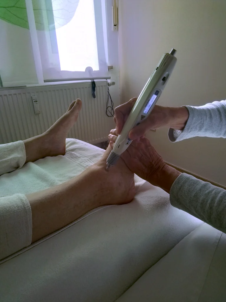 Laserbehandlung am Fuß einer liegenden Patientin im Behandlungsraum
